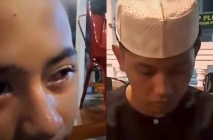 Mata Lebam Santri Banyuasin Diduga Dianiaya Ustaz, Kasus Sudah Dilaporkan ke Polisi